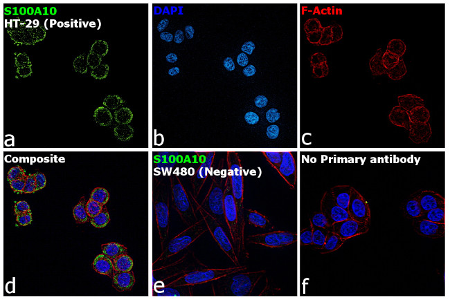 S100A10 Antibody in Immunocytochemistry (ICC/IF)