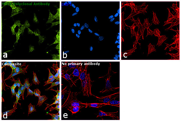 MSI1 Antibody in Immunocytochemistry (ICC/IF)