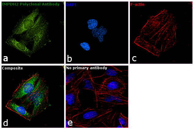IMPDH2 Antibody in Immunocytochemistry (ICC/IF)