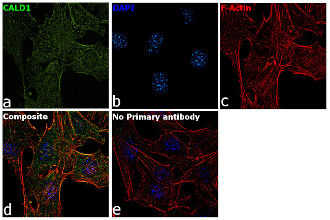 Caldesmon Antibody in Immunocytochemistry (ICC/IF)