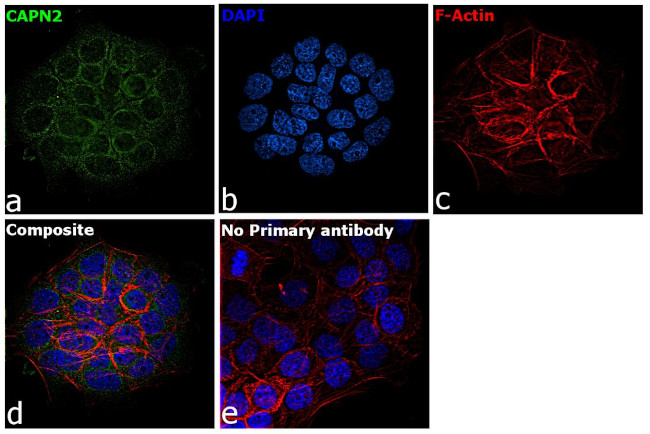 Calpain 2 Antibody in Immunocytochemistry (ICC/IF)