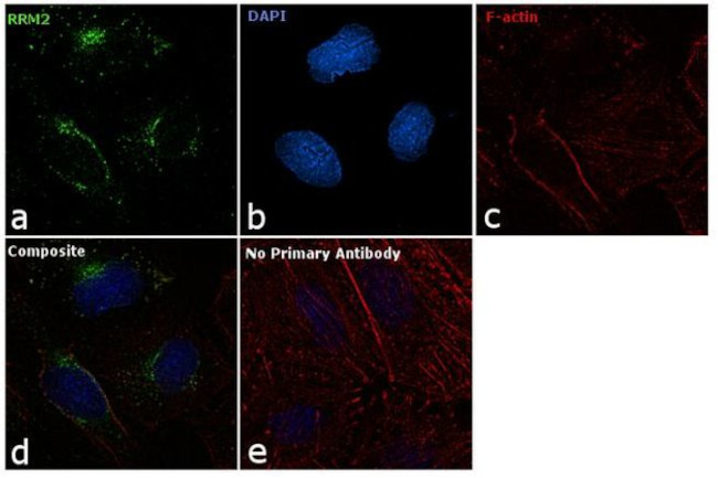 RRM2 Antibody in Immunocytochemistry (ICC/IF)