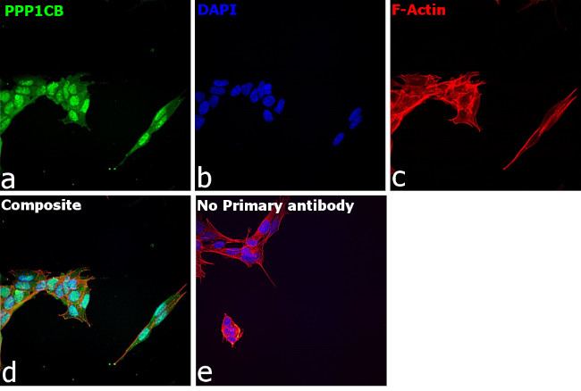 PP1 beta Antibody in Immunocytochemistry (ICC/IF)
