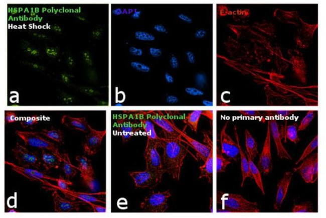 HSP70 Antibody in Immunocytochemistry (ICC/IF)