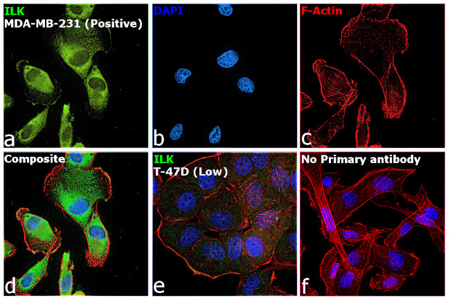 ILK Antibody in Immunocytochemistry (ICC/IF)
