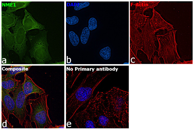 NME1 Antibody in Immunocytochemistry (ICC/IF)