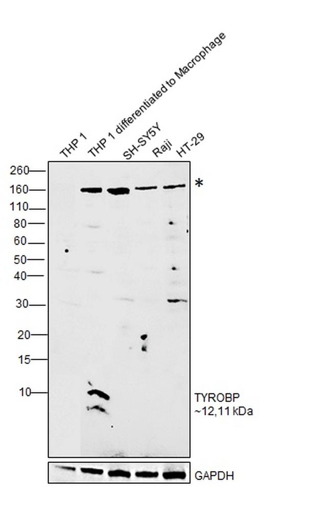 TYROBP Antibody in Western Blot (WB)