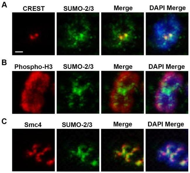 Smc3 Rates SMC3 Polyclonal Antibody | Invitrogen (PA5-29131)