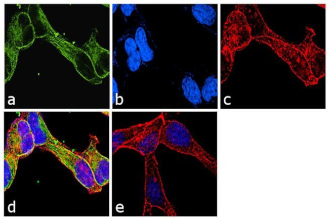 TUBA8 Antibody in Immunocytochemistry (ICC/IF)