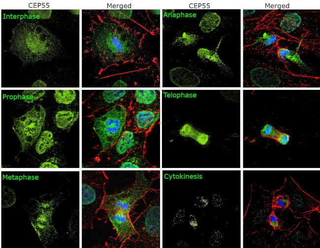 CEP55 Antibody in Immunocytochemistry (ICC/IF)