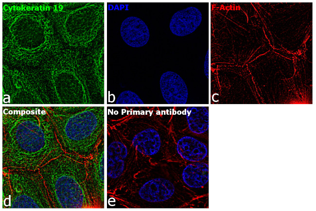 Cytokeratin 19 Antibody in Immunocytochemistry (ICC/IF)