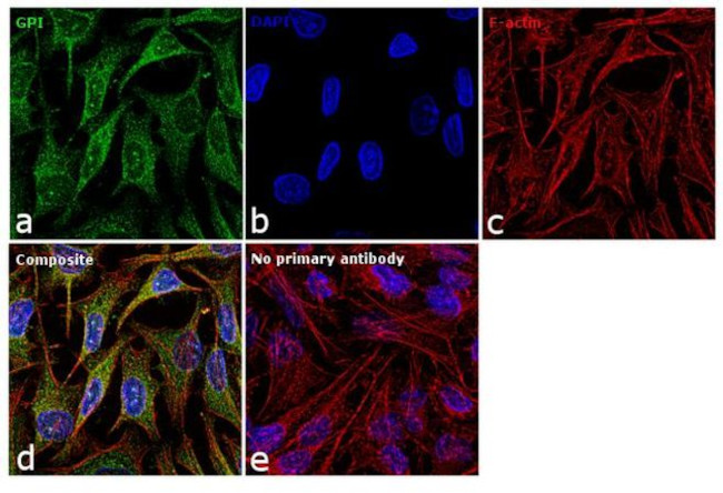GPI Antibody in Immunocytochemistry (ICC/IF)