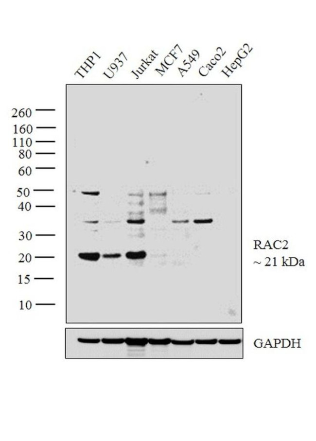 Askey Rac2 RAC2 Polyclonal Antibody | Invitrogen (PA5-29681)