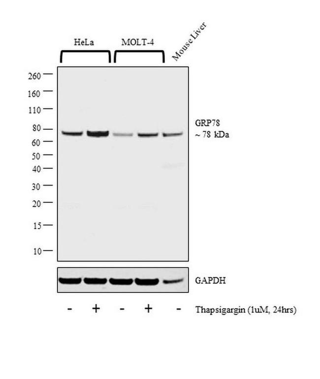 GRP78 Antibody in Western Blot (WB)