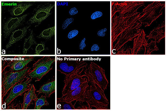 Emerin Antibody in Immunocytochemistry (ICC/IF)