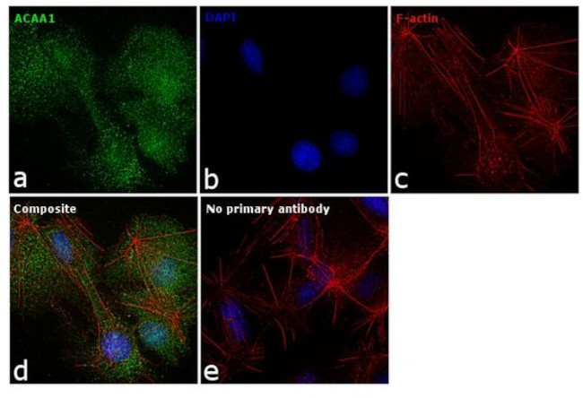 ACAA1 Antibody in Immunocytochemistry (ICC/IF)