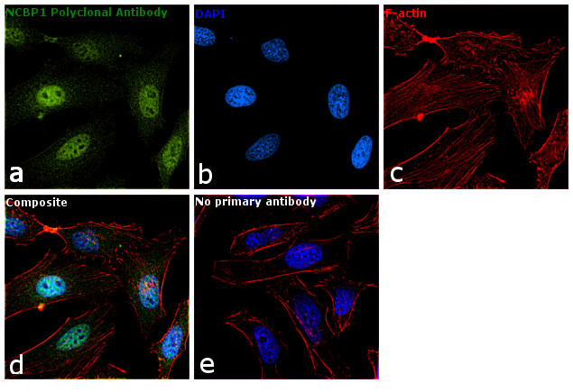 NCBP1 Antibody in Immunocytochemistry (ICC/IF)