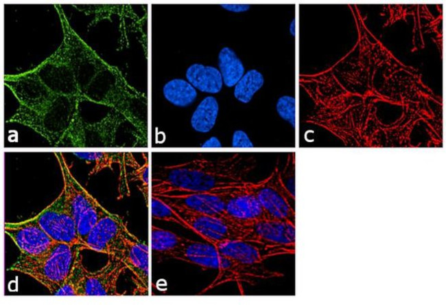 Tubulin beta-2C Antibody in Immunocytochemistry (ICC/IF)