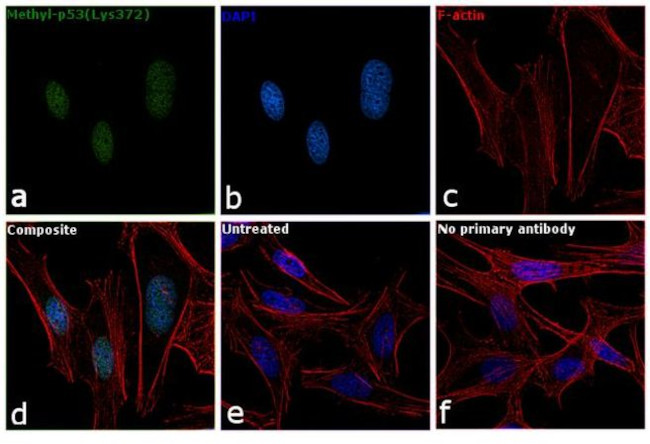 Methyl-p53 (Lys372) Antibody in Immunocytochemistry (ICC/IF)
