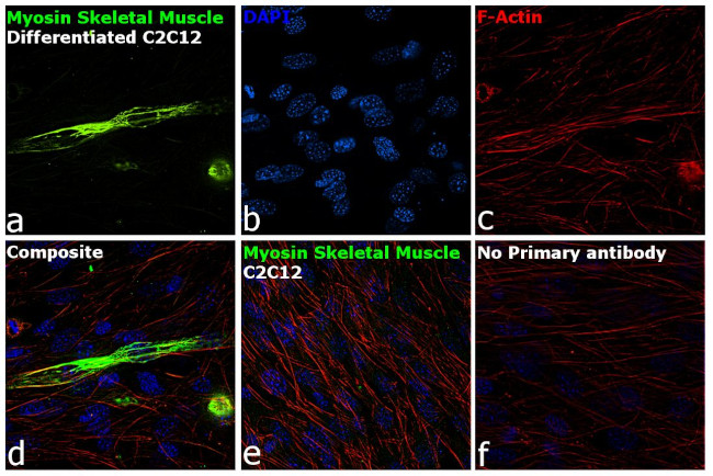 MYH1 Antibody in Immunocytochemistry (ICC/IF)