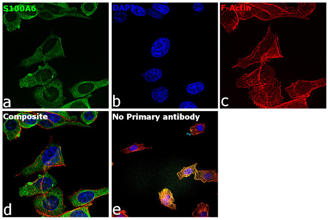 S100A6 Antibody in Immunocytochemistry (ICC/IF)
