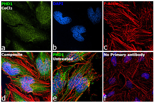 PHD1 Antibody in Immunocytochemistry (ICC/IF)