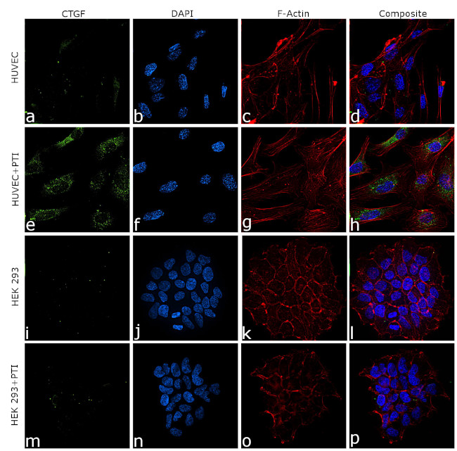 CTGF Antibody in Immunocytochemistry (ICC/IF)
