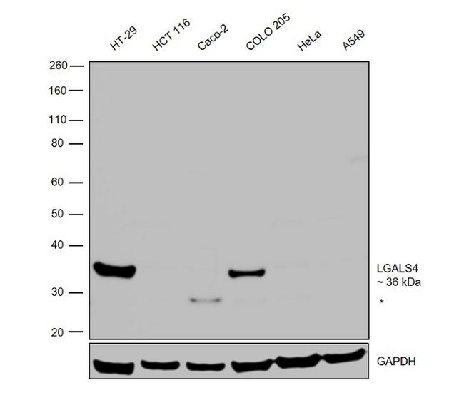 Galectin 4 Antibody in Western Blot (WB)