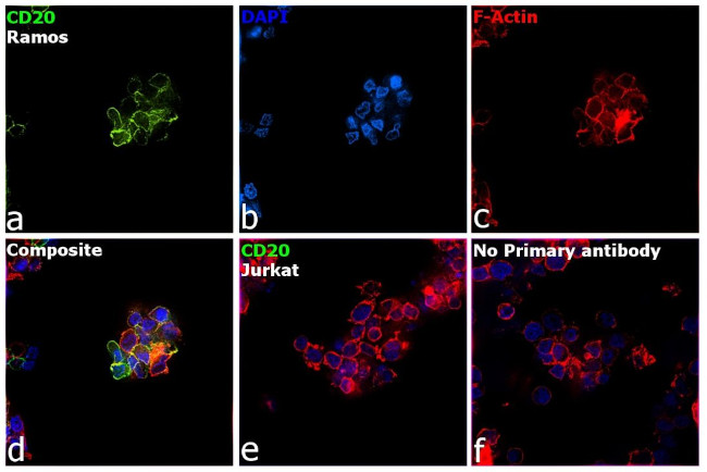 CD20 Antibody in Immunocytochemistry (ICC/IF)