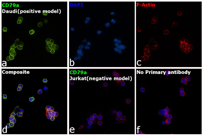 CD79a Antibody in Immunocytochemistry (ICC/IF)