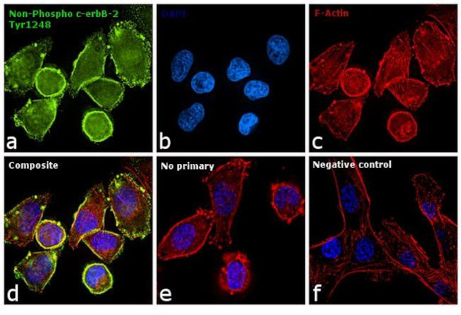 ErbB2 (HER-2) Antibody in Immunocytochemistry (ICC/IF)