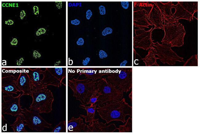 Cyclin E Antibody in Immunocytochemistry (ICC/IF)
