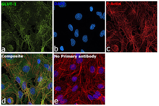 GLUT1 Antibody in Immunocytochemistry (ICC/IF)