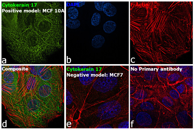 Cytokeratin 17 Antibody in Immunocytochemistry (ICC/IF)