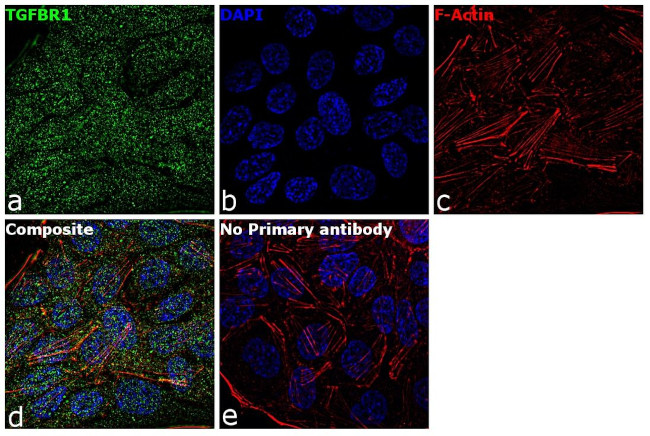 TGFBR1 Antibody in Immunocytochemistry (ICC/IF)