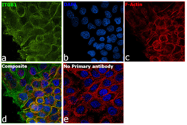 ITGB1 Antibody in Immunocytochemistry (ICC/IF)