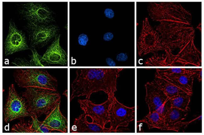 Rat IgG (H+L) Secondary Antibody in Immunocytochemistry (ICC/IF)