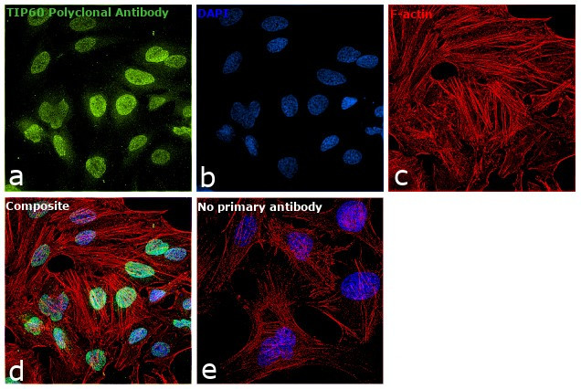 TIP60 Antibody in Immunocytochemistry (ICC/IF)