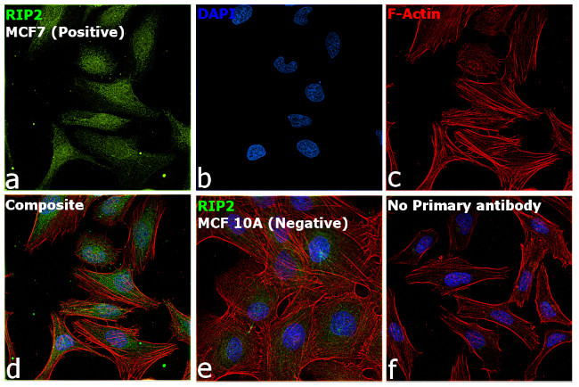 RIP2 Antibody in Immunocytochemistry (ICC/IF)