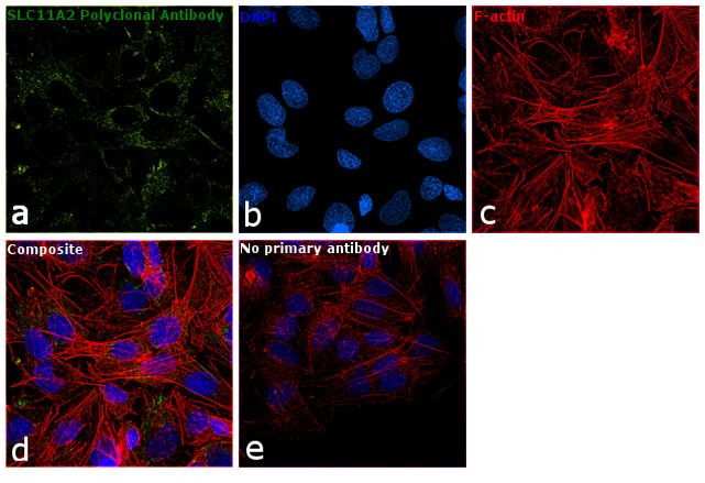 SLC11A2 Antibody in Immunocytochemistry (ICC/IF)