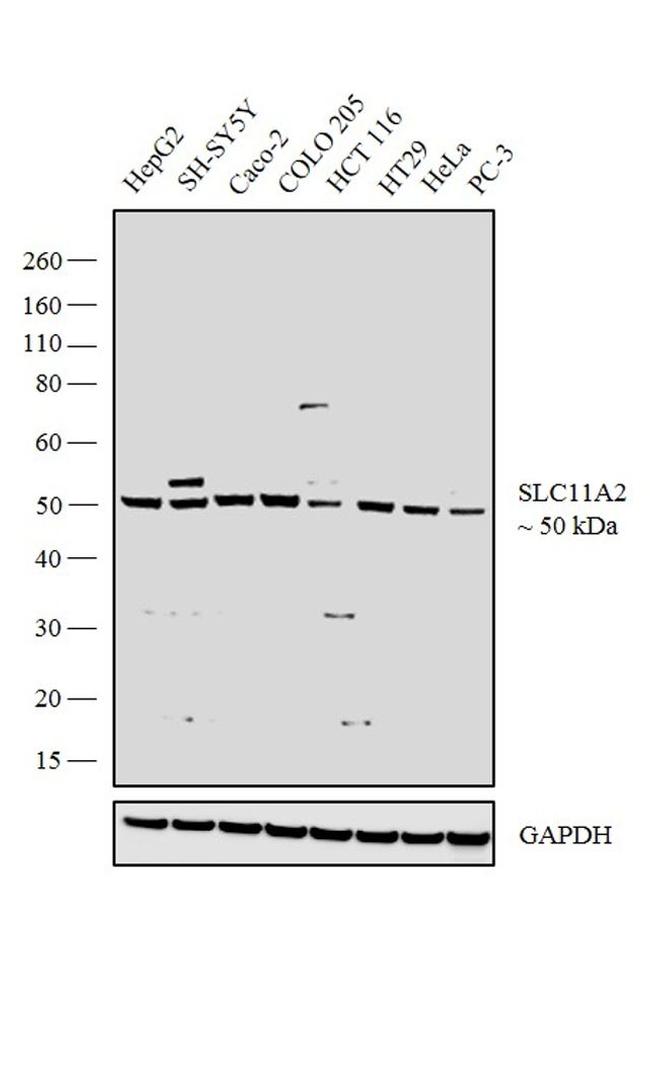 SLC11A2 Polyclonal Antibody | Invitrogen (PA5-35136)