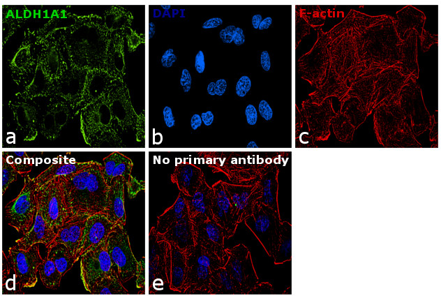 ALDH1A1 Antibody in Immunocytochemistry (ICC/IF)