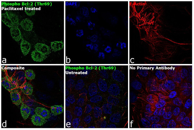 Phospho-Bcl-2 (Thr69) Antibody in Immunocytochemistry (ICC/IF)