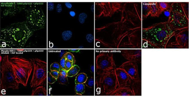 Phospho-ErbB2 (HER-2) (Tyr1221, Tyr1222) Antibody in Immunocytochemistry (ICC/IF)