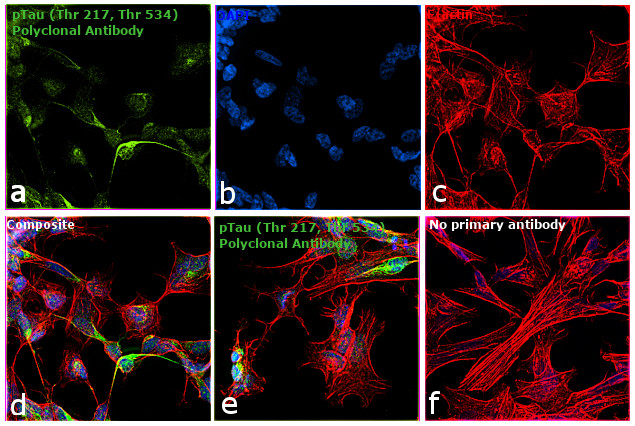 Phospho-Tau (Thr217) Antibody in Immunocytochemistry (ICC/IF)