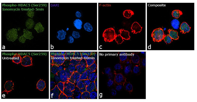 Phospho-HDAC5 (Ser259) Antibody in Immunocytochemistry (ICC/IF)