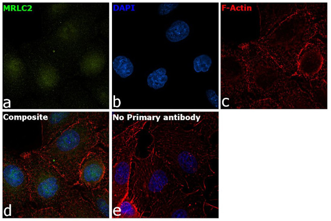 MRLC2 Antibody in Immunocytochemistry (ICC/IF)