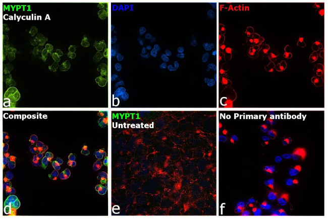 Phospho-MYPT1 (Thr696) Antibody in Immunocytochemistry (ICC/IF)