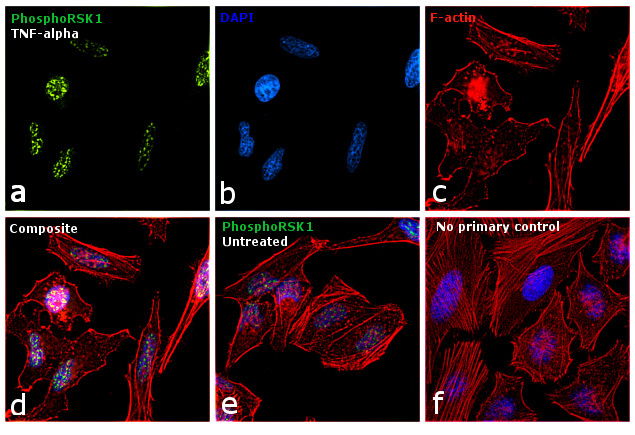 Phospho-RSK1 (Thr359, Ser363) Antibody in Immunocytochemistry (ICC/IF)