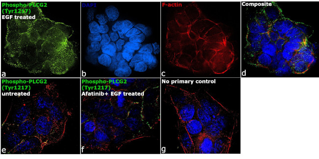 Phospho-PLCG2 (Tyr1217) Antibody in Immunocytochemistry (ICC/IF)